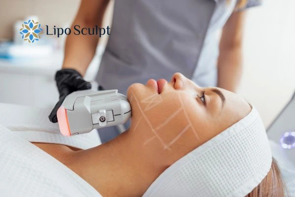 HIFU vs Botulinum Toxin: Understanding the Differences 1 HIFU vs Botox The Potteries What is the best option for you?