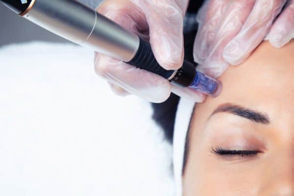 Explaining Total Skin Tightening Treatment and What to Expect 2 What Skin Concerns Can Total Skin Tightening Treatment Help With The Potteries?