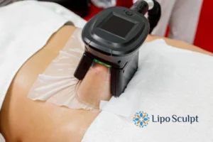 Does Fat Freezing At Home Work? 3 Fat freezing at home from Lipo Sculpt The Potteries